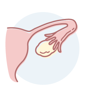 CDSM-OVARY-header-icon.png